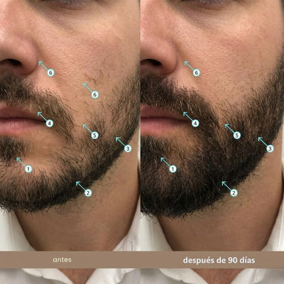 Viareline Spectral Men's™ Nanoxidil al 5%