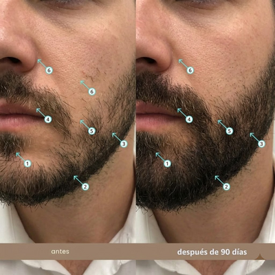 Viareline Spectral Men's™ Nanoxidil al 5%