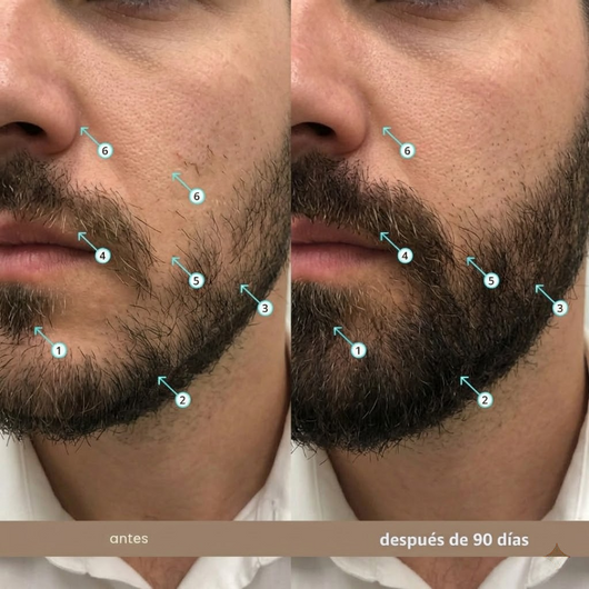 Viareline Spectral Men's™ Nanoxidil al 5%