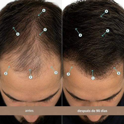 Viareline™ Spectral Men's Nanoxidil al 5%