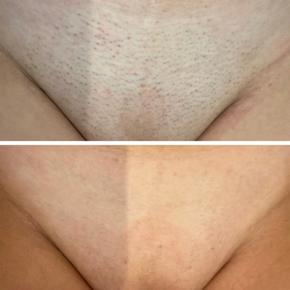 3. Seguro para todas las zonas de tu cuerpo.